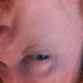 20170609_172547