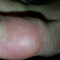 20151216_185250